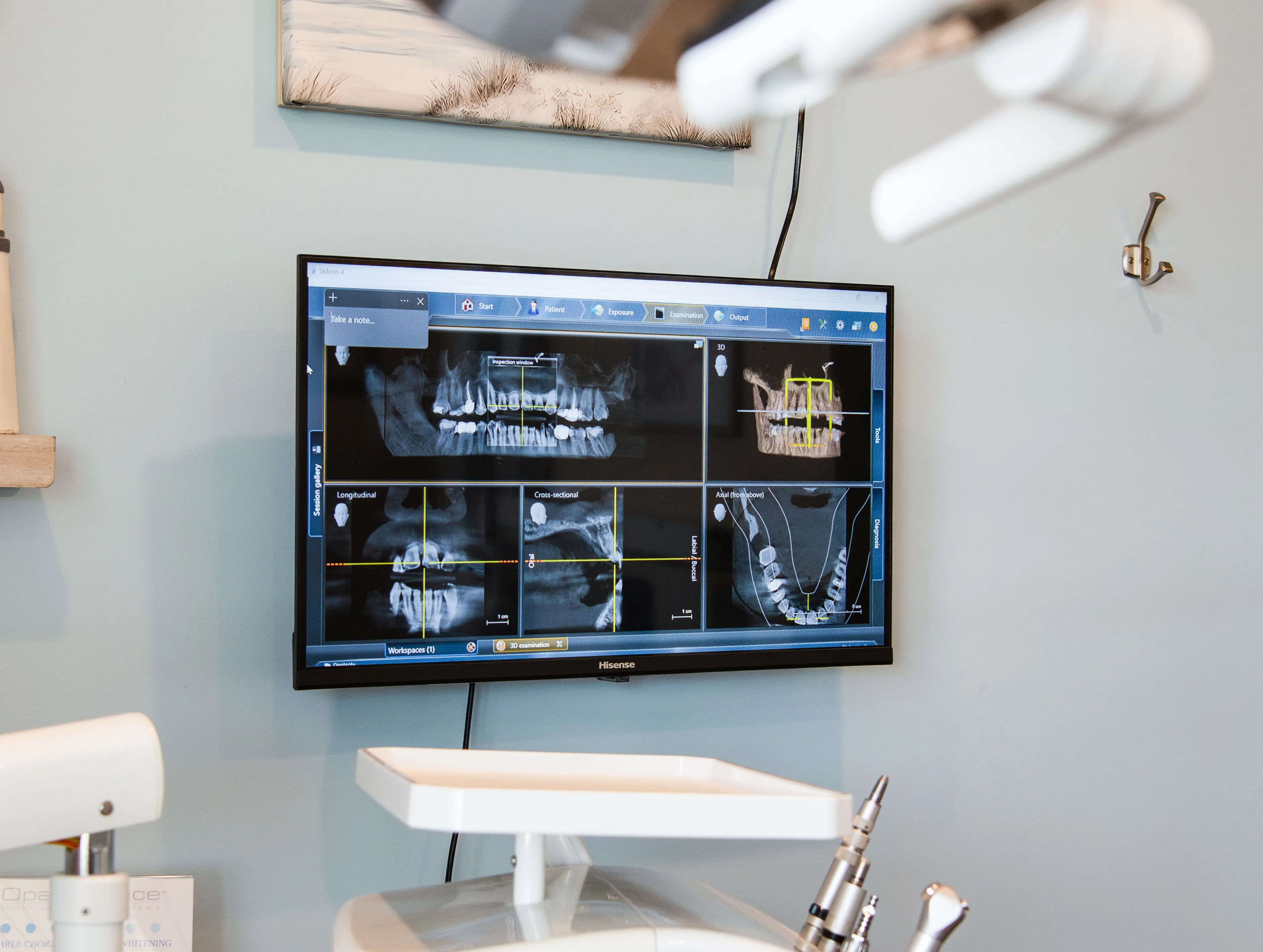 Digital dental X-rays at Hopefield Family Dentistry